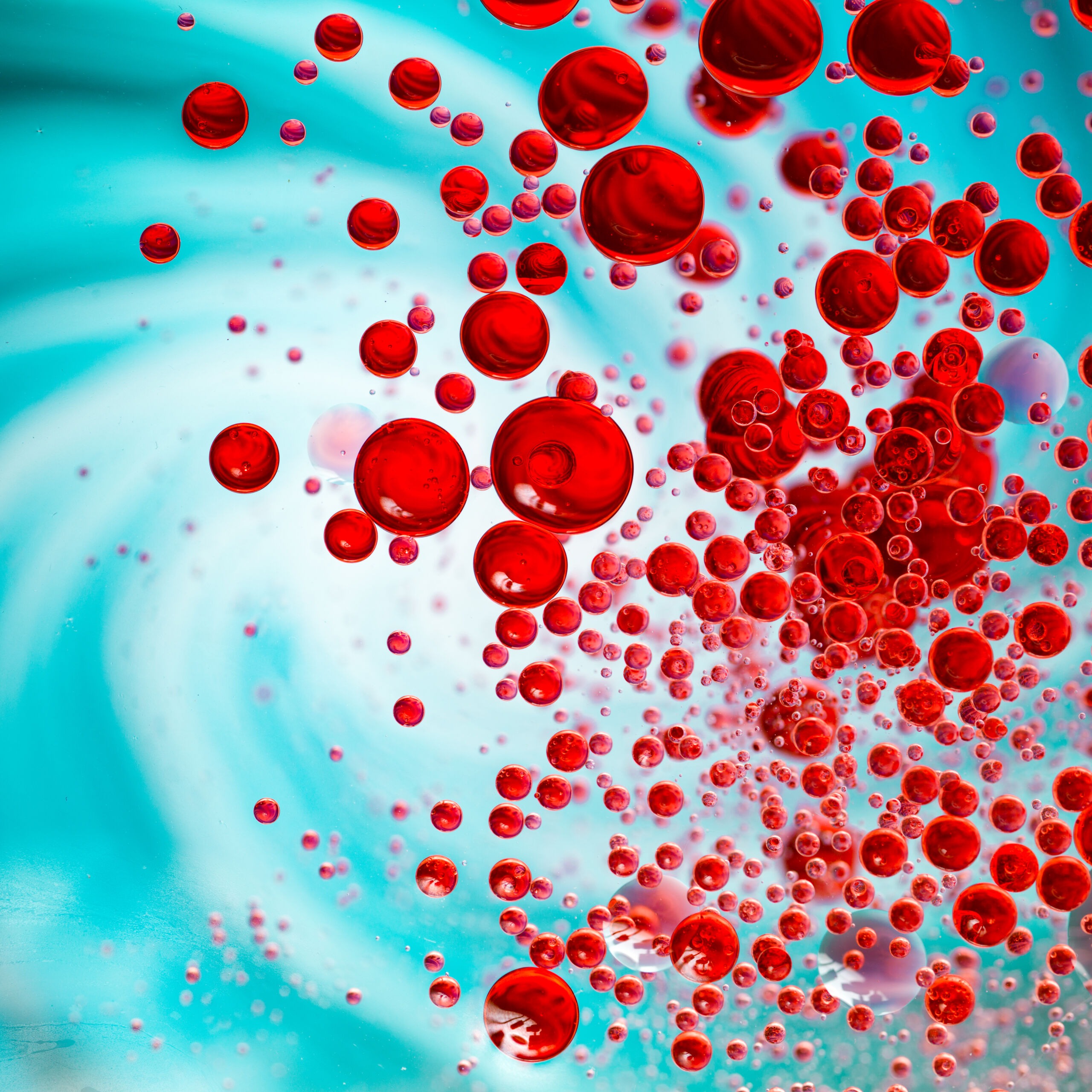 Sepsis Negligence Claims